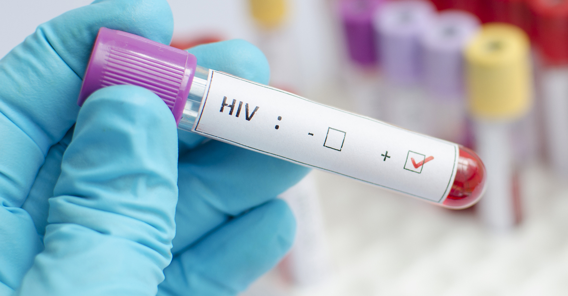 Anvisa aprova novo tratamento para HIV